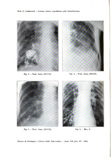 Rivista di patologia e clinica della tubercolosi organo ufficiale della Società italiana fascista di studi scientifici sulla tubercolosi