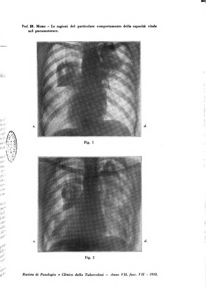 Rivista di patologia e clinica della tubercolosi organo ufficiale della Società italiana fascista di studi scientifici sulla tubercolosi