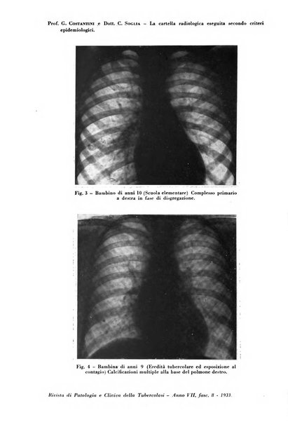 Rivista di patologia e clinica della tubercolosi organo ufficiale della Società italiana fascista di studi scientifici sulla tubercolosi