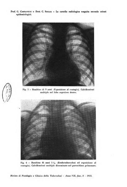 Rivista di patologia e clinica della tubercolosi organo ufficiale della Società italiana fascista di studi scientifici sulla tubercolosi