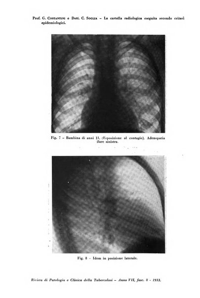 Rivista di patologia e clinica della tubercolosi organo ufficiale della Società italiana fascista di studi scientifici sulla tubercolosi