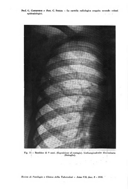 Rivista di patologia e clinica della tubercolosi organo ufficiale della Società italiana fascista di studi scientifici sulla tubercolosi