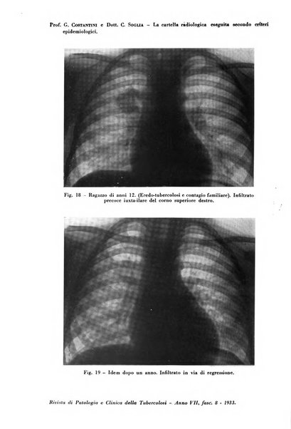 Rivista di patologia e clinica della tubercolosi organo ufficiale della Società italiana fascista di studi scientifici sulla tubercolosi