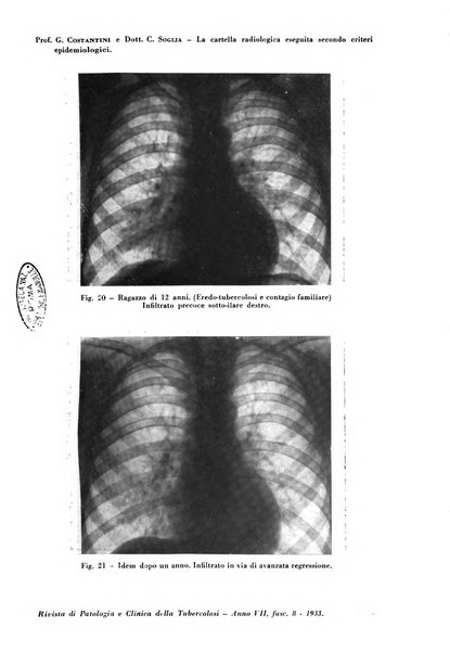 Rivista di patologia e clinica della tubercolosi organo ufficiale della Società italiana fascista di studi scientifici sulla tubercolosi