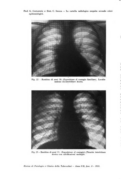 Rivista di patologia e clinica della tubercolosi organo ufficiale della Società italiana fascista di studi scientifici sulla tubercolosi