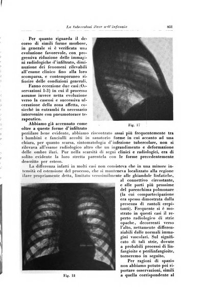 Rivista di patologia e clinica della tubercolosi organo ufficiale della Società italiana fascista di studi scientifici sulla tubercolosi