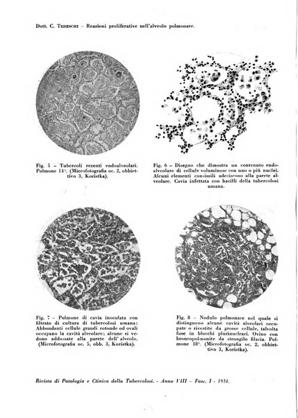 Rivista di patologia e clinica della tubercolosi organo ufficiale della Società italiana fascista di studi scientifici sulla tubercolosi