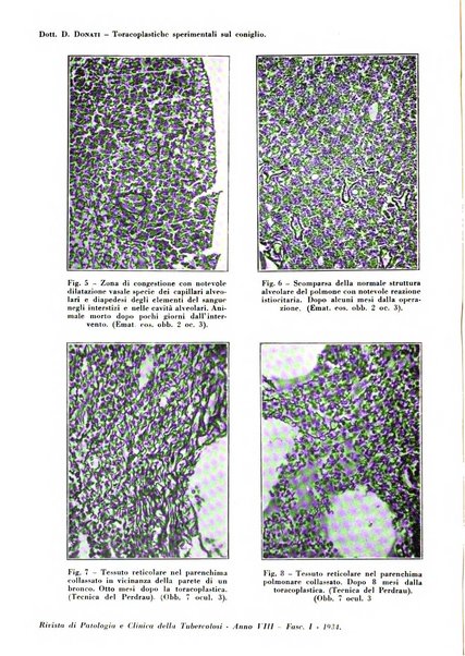 Rivista di patologia e clinica della tubercolosi organo ufficiale della Società italiana fascista di studi scientifici sulla tubercolosi