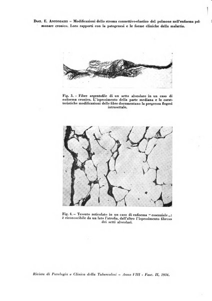 Rivista di patologia e clinica della tubercolosi organo ufficiale della Società italiana fascista di studi scientifici sulla tubercolosi