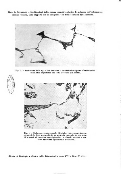 Rivista di patologia e clinica della tubercolosi organo ufficiale della Società italiana fascista di studi scientifici sulla tubercolosi