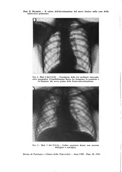 Rivista di patologia e clinica della tubercolosi organo ufficiale della Società italiana fascista di studi scientifici sulla tubercolosi