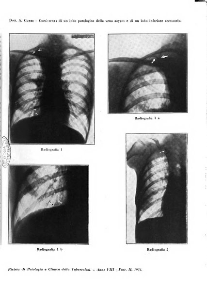 Rivista di patologia e clinica della tubercolosi organo ufficiale della Società italiana fascista di studi scientifici sulla tubercolosi