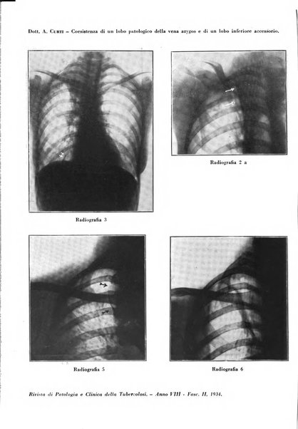 Rivista di patologia e clinica della tubercolosi organo ufficiale della Società italiana fascista di studi scientifici sulla tubercolosi