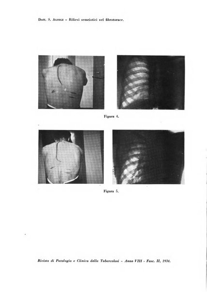 Rivista di patologia e clinica della tubercolosi organo ufficiale della Società italiana fascista di studi scientifici sulla tubercolosi