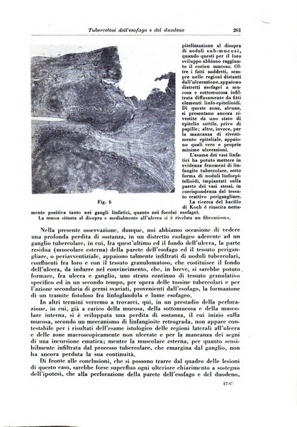 Rivista di patologia e clinica della tubercolosi organo ufficiale della Società italiana fascista di studi scientifici sulla tubercolosi