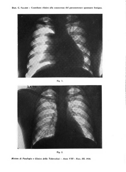 Rivista di patologia e clinica della tubercolosi organo ufficiale della Società italiana fascista di studi scientifici sulla tubercolosi