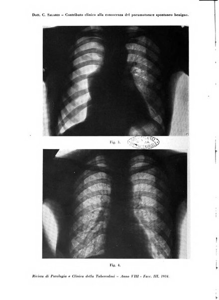 Rivista di patologia e clinica della tubercolosi organo ufficiale della Società italiana fascista di studi scientifici sulla tubercolosi