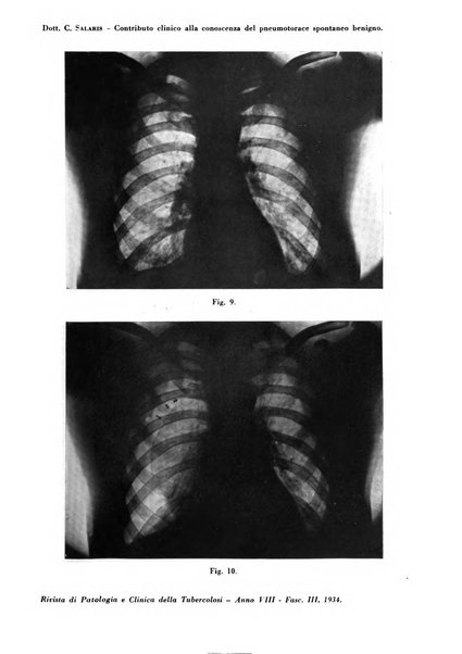 Rivista di patologia e clinica della tubercolosi organo ufficiale della Società italiana fascista di studi scientifici sulla tubercolosi