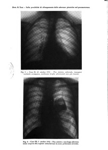 Rivista di patologia e clinica della tubercolosi organo ufficiale della Società italiana fascista di studi scientifici sulla tubercolosi