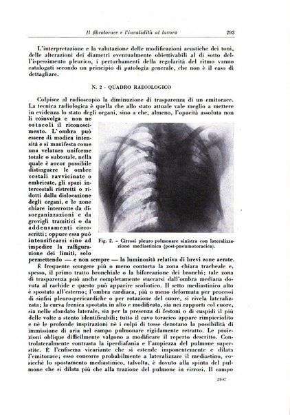 Rivista di patologia e clinica della tubercolosi organo ufficiale della Società italiana fascista di studi scientifici sulla tubercolosi