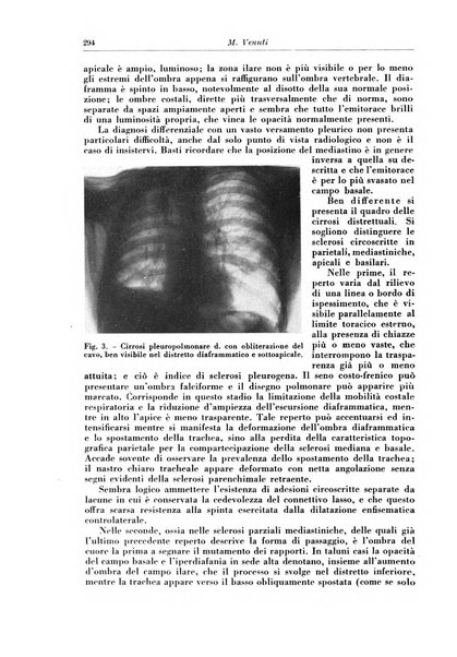 Rivista di patologia e clinica della tubercolosi organo ufficiale della Società italiana fascista di studi scientifici sulla tubercolosi