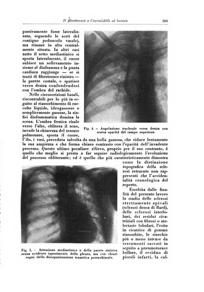 Rivista di patologia e clinica della tubercolosi organo ufficiale della Società italiana fascista di studi scientifici sulla tubercolosi