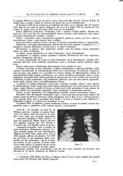 Rivista di patologia e clinica della tubercolosi organo ufficiale della Società italiana fascista di studi scientifici sulla tubercolosi