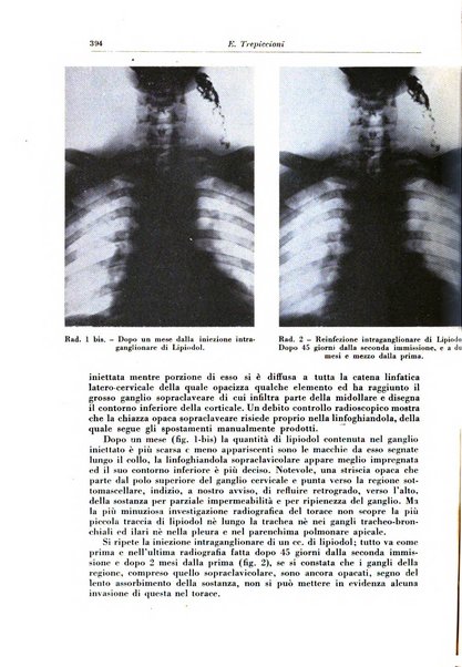 Rivista di patologia e clinica della tubercolosi organo ufficiale della Società italiana fascista di studi scientifici sulla tubercolosi