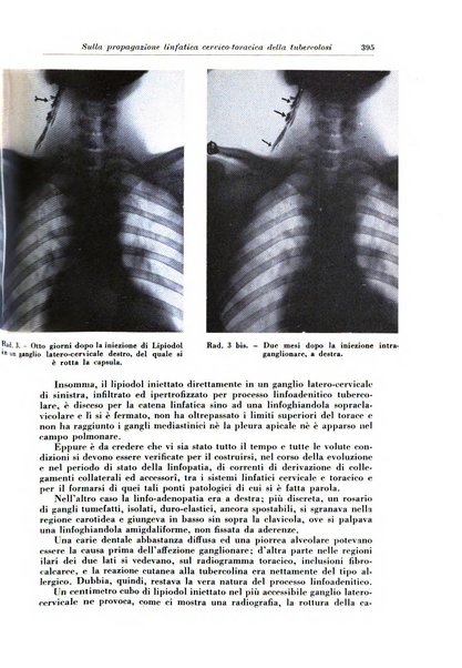 Rivista di patologia e clinica della tubercolosi organo ufficiale della Società italiana fascista di studi scientifici sulla tubercolosi