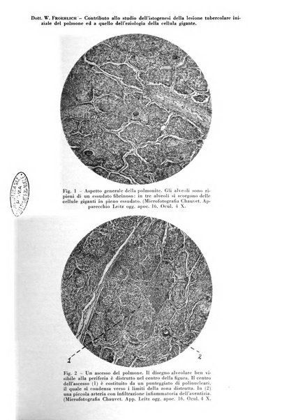 Rivista di patologia e clinica della tubercolosi organo ufficiale della Società italiana fascista di studi scientifici sulla tubercolosi