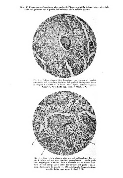 Rivista di patologia e clinica della tubercolosi organo ufficiale della Società italiana fascista di studi scientifici sulla tubercolosi