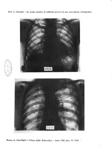 Rivista di patologia e clinica della tubercolosi organo ufficiale della Società italiana fascista di studi scientifici sulla tubercolosi