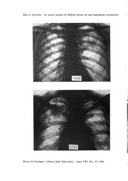 Rivista di patologia e clinica della tubercolosi organo ufficiale della Società italiana fascista di studi scientifici sulla tubercolosi