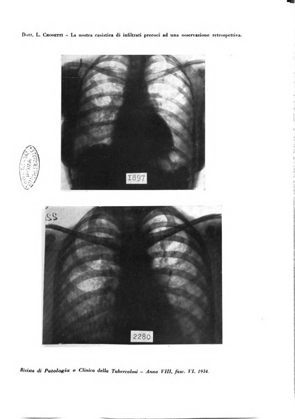 Rivista di patologia e clinica della tubercolosi organo ufficiale della Società italiana fascista di studi scientifici sulla tubercolosi