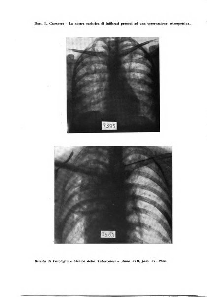 Rivista di patologia e clinica della tubercolosi organo ufficiale della Società italiana fascista di studi scientifici sulla tubercolosi