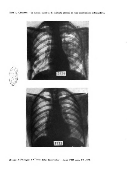 Rivista di patologia e clinica della tubercolosi organo ufficiale della Società italiana fascista di studi scientifici sulla tubercolosi