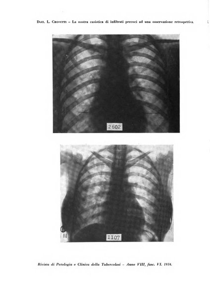 Rivista di patologia e clinica della tubercolosi organo ufficiale della Società italiana fascista di studi scientifici sulla tubercolosi