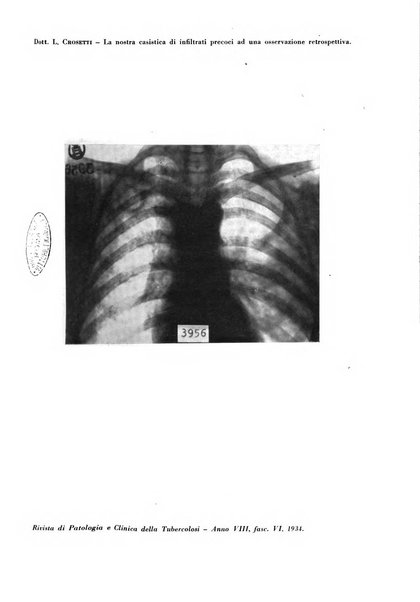 Rivista di patologia e clinica della tubercolosi organo ufficiale della Società italiana fascista di studi scientifici sulla tubercolosi