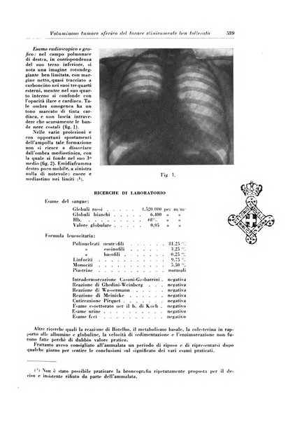 Rivista di patologia e clinica della tubercolosi organo ufficiale della Società italiana fascista di studi scientifici sulla tubercolosi