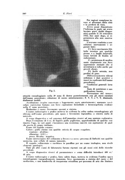 Rivista di patologia e clinica della tubercolosi organo ufficiale della Società italiana fascista di studi scientifici sulla tubercolosi