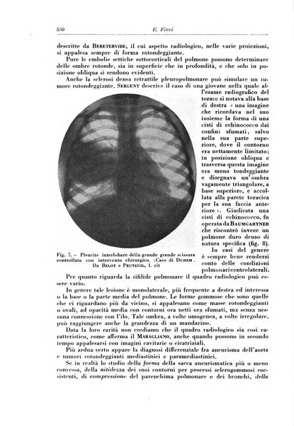 Rivista di patologia e clinica della tubercolosi organo ufficiale della Società italiana fascista di studi scientifici sulla tubercolosi