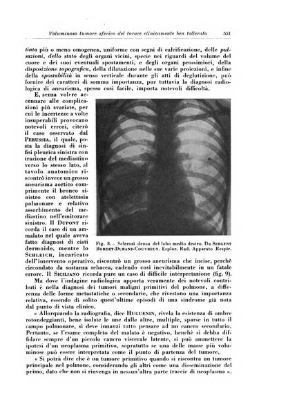 Rivista di patologia e clinica della tubercolosi organo ufficiale della Società italiana fascista di studi scientifici sulla tubercolosi