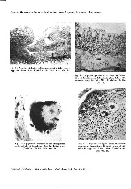 Rivista di patologia e clinica della tubercolosi organo ufficiale della Società italiana fascista di studi scientifici sulla tubercolosi