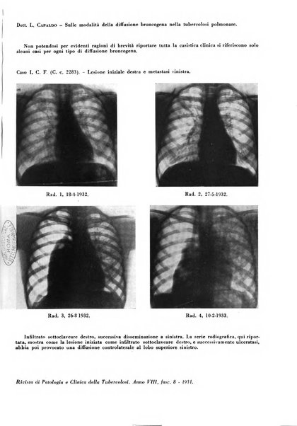 Rivista di patologia e clinica della tubercolosi organo ufficiale della Società italiana fascista di studi scientifici sulla tubercolosi