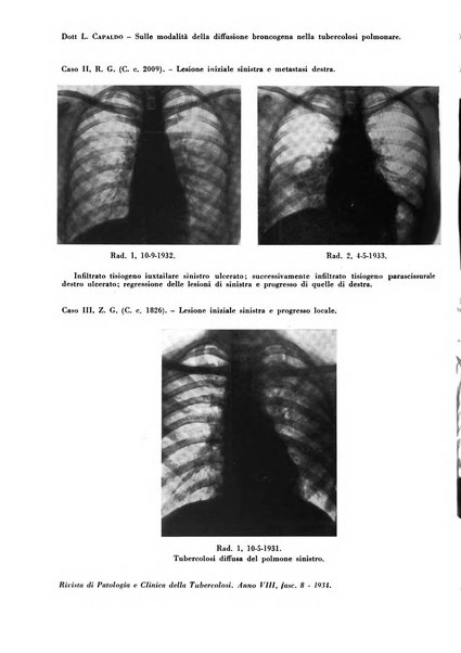 Rivista di patologia e clinica della tubercolosi organo ufficiale della Società italiana fascista di studi scientifici sulla tubercolosi