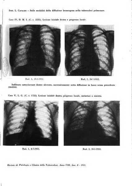 Rivista di patologia e clinica della tubercolosi organo ufficiale della Società italiana fascista di studi scientifici sulla tubercolosi