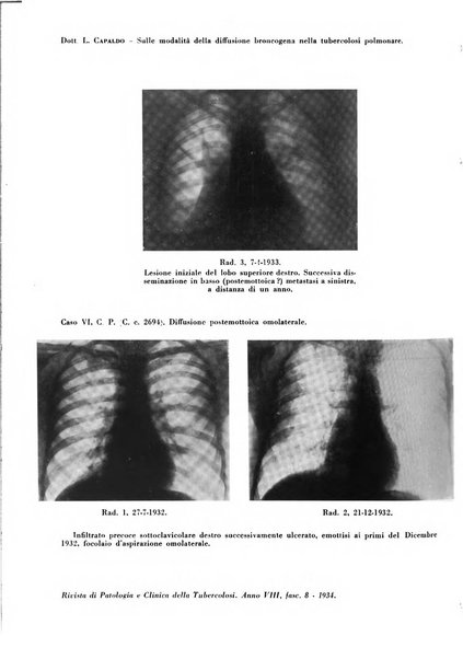 Rivista di patologia e clinica della tubercolosi organo ufficiale della Società italiana fascista di studi scientifici sulla tubercolosi