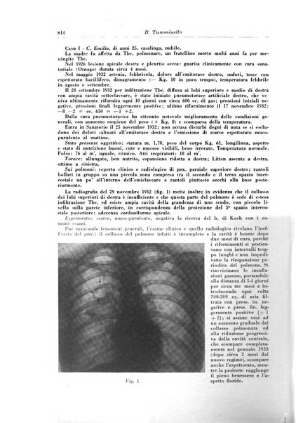 Rivista di patologia e clinica della tubercolosi organo ufficiale della Società italiana fascista di studi scientifici sulla tubercolosi