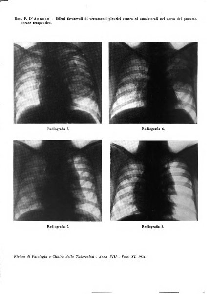 Rivista di patologia e clinica della tubercolosi organo ufficiale della Società italiana fascista di studi scientifici sulla tubercolosi