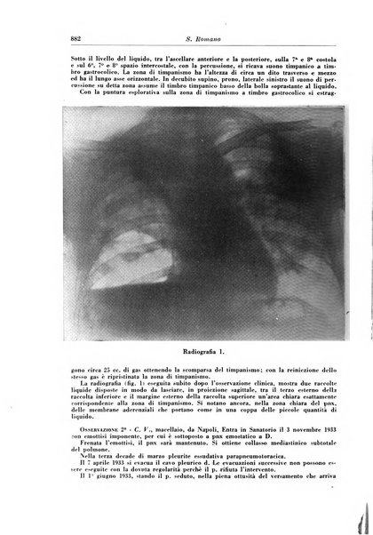 Rivista di patologia e clinica della tubercolosi organo ufficiale della Società italiana fascista di studi scientifici sulla tubercolosi